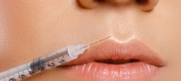 dermal fillers